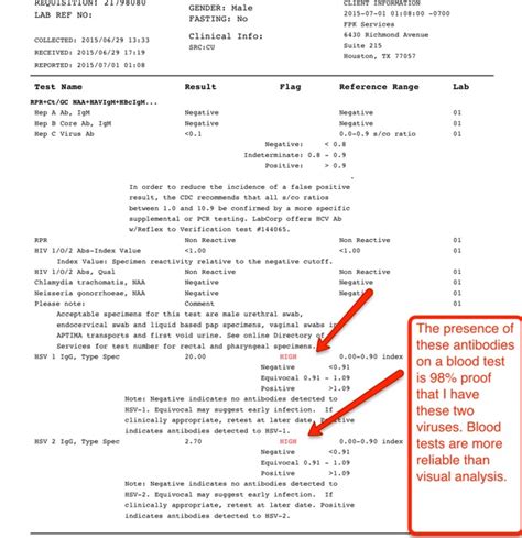 how to read std results|Understanding Your Lab Results .